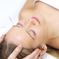 image Acupuncture